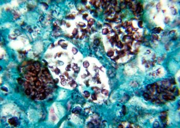 중부 테네시 히스토플라스모시스 집단 발병…노스캐롤라이나 확산 가능성은?