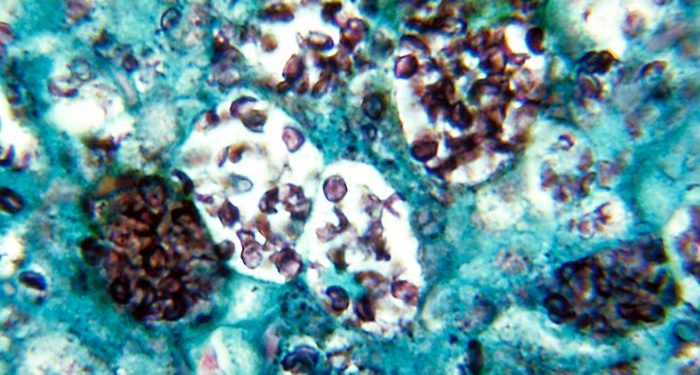 중부 테네시 히스토플라스모시스 집단 발병…노스캐롤라이나 확산 가능성은?