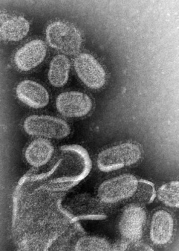 늦겨울 독감 기승… ‘B형 바이러스’ 소아·청소년 강타
