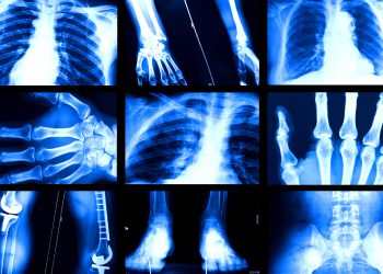 AI와 의료 현장: 방사선학이 보여주는 미래 직업의 풍경