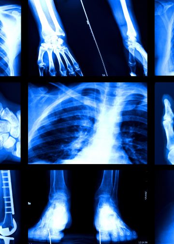 AI와 의료 현장: 방사선학이 보여주는 미래 직업의 풍경