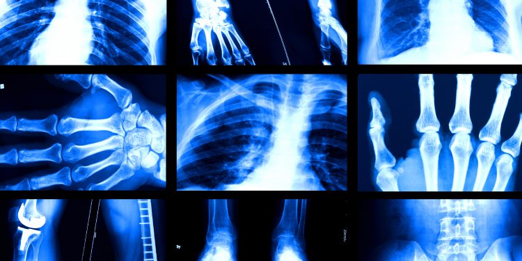 AI와 의료 현장: 방사선학이 보여주는 미래 직업의 풍경