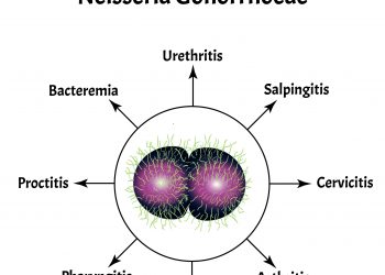켄트발 ‘B형 수막염’ 유럽 상륙… ‘슈퍼 전파’에 보건당국 비상
