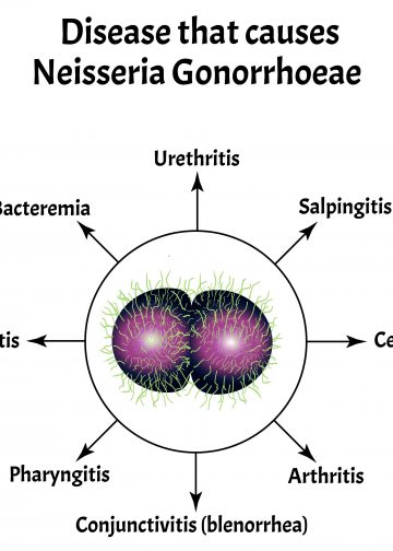 켄트발 ‘B형 수막염’ 유럽 상륙… ‘슈퍼 전파’에 보건당국 비상