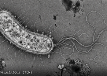 롱아일랜드 수역서 ‘식인 박테리아’ 검출…치명률 20% 경고 속 확산 우려