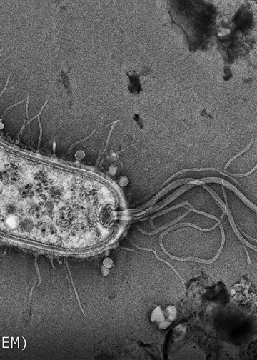 롱아일랜드 수역서 ‘식인 박테리아’ 검출…치명률 20% 경고 속 확산 우려