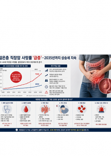 젊은층 직장암 사망률 ‘급증’…2035년까지 상승세 지속 경고