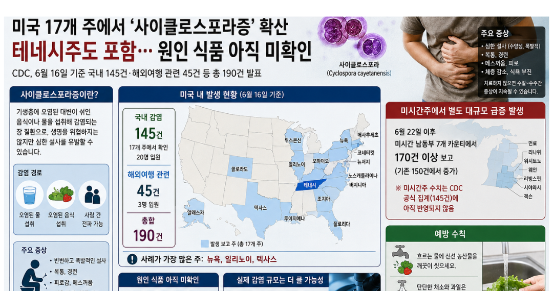 미 사이클로스포라증 빠르게 확산…17개 주 145명, 테네시 포함…미시간선 별도 170명 급증