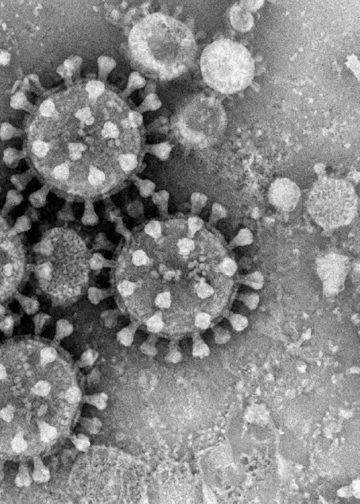 코로나19 재확산 조짐…CDC “41개 주서 감염 증가”